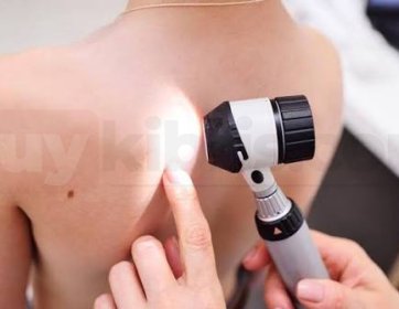 Dermatoskop Bakısı