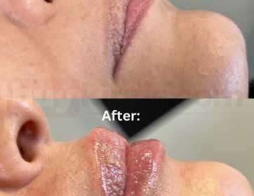 Sizin için en güzel dudakları tasarlıyoruz