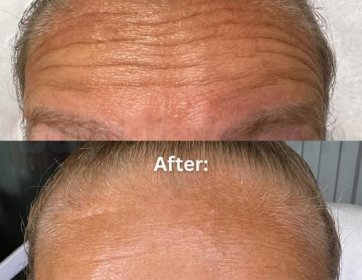 Kırışıklık mı? Biz tanımıyoruz. 😉✨ 