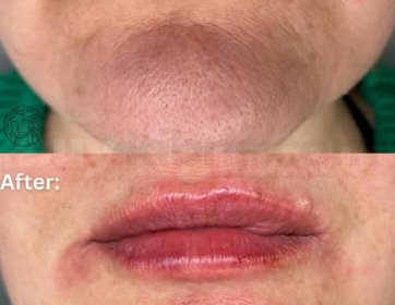 Bazen küçük değişiklikler, büyük farklar yaratır. 