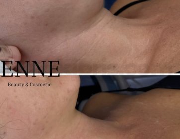 Tek seansta genç ve sıkı bir boyun!