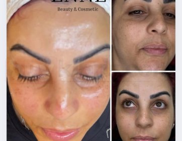 Cildine Somon Işıltısı Kat! | Epirenew Somon DNA Bakımı