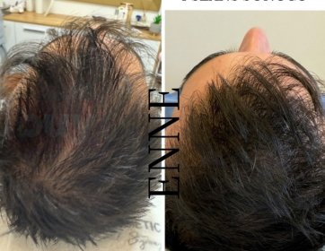 SAÇLARINIZA YENİDEN HAYAT VERİN!