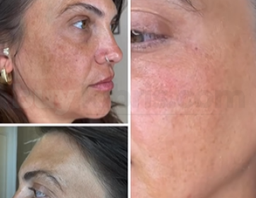 Cilt Yaşar, Hayat İz Bırakır… Ama Glamen Care ile Bu İzlere Dokunuruz.