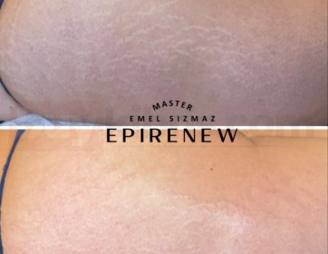 Hayal Değil, Gerçek Sonuç!