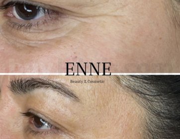 ✨ Glamen Care Protokolü: Dört Mevsim Cilt Işıltısı! ✨