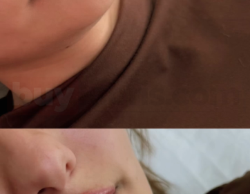 Dudak Kontur ve Hacim Uygulaması