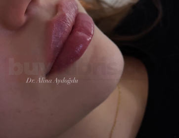 Belirgin ve Dengeli Dudaklar