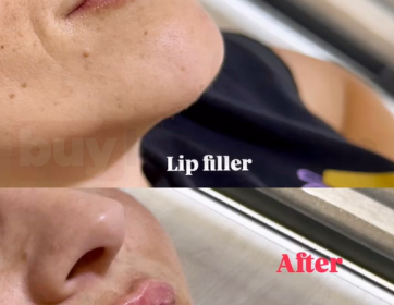 Doğal Hacimli Dudak Görünümü