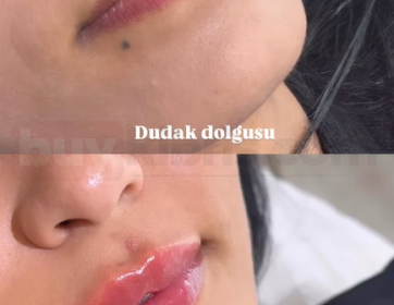 Doğal Işıltılı Dudak Dolgusu