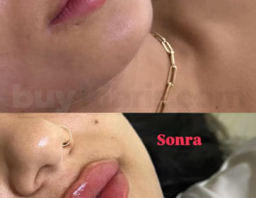 Dolgun ve Dengeli Dudak Formu