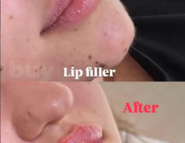 Dolgun ve Pürüzsüz Dudak Görünümü