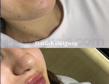 Doğal Hacim ve Işıltılı Dudaklar