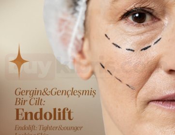 Endolift Cilt Sıkılaştırma Uygulaması